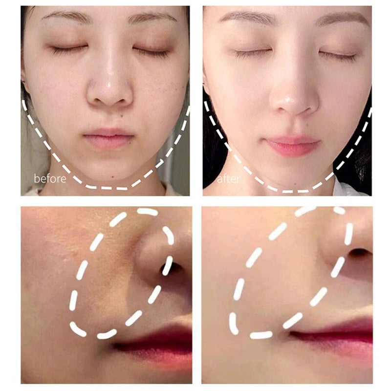 Face Lifting Massager